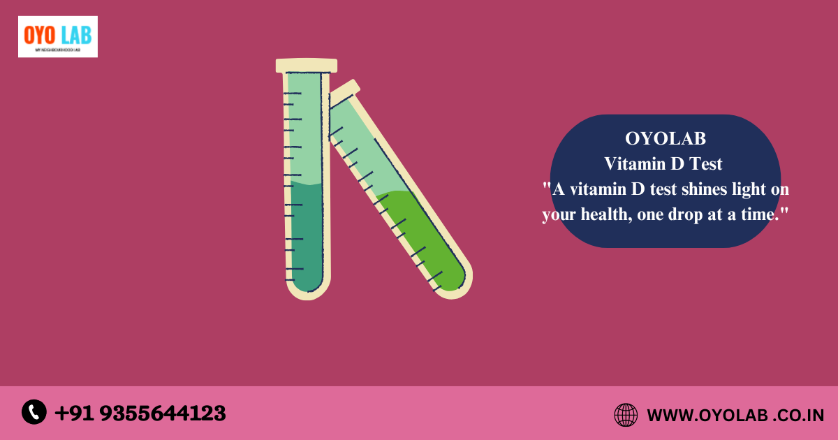 Vitamin D Test In Sangam Vihar