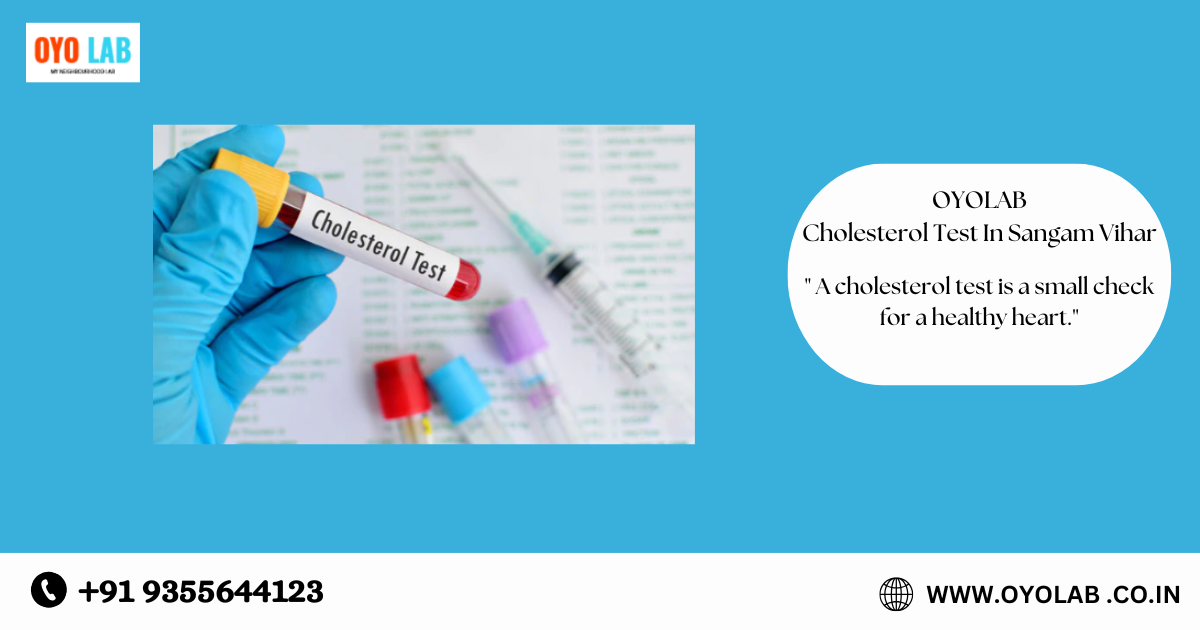 Cholesterol Test In Sangam Vihar