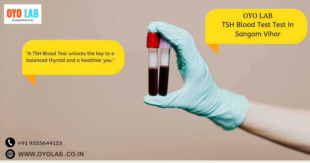 TSH Blood Test In Sangam Vihar