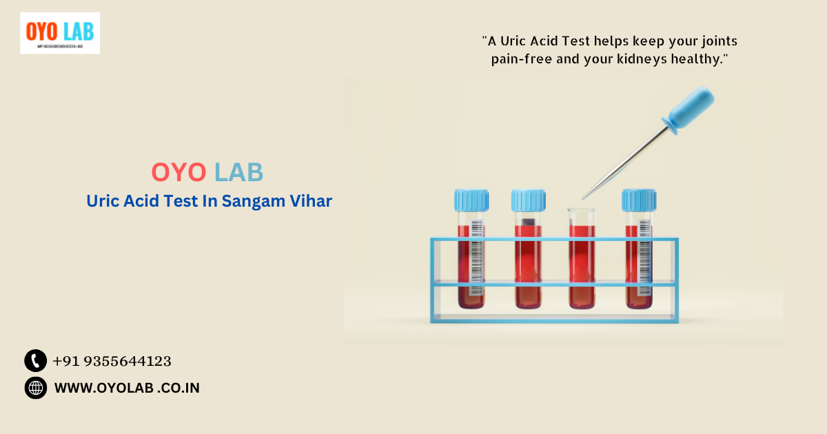 Uric Acid Test In Sangam Vihar