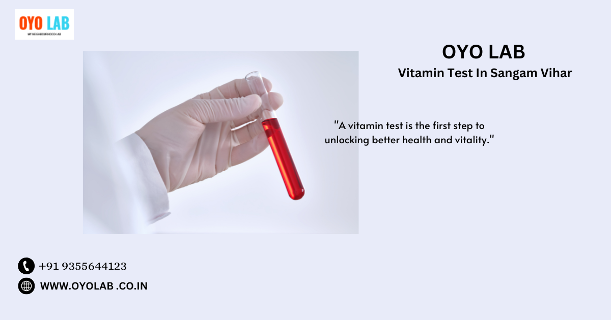 Vitamin Test In Sangam Vihar