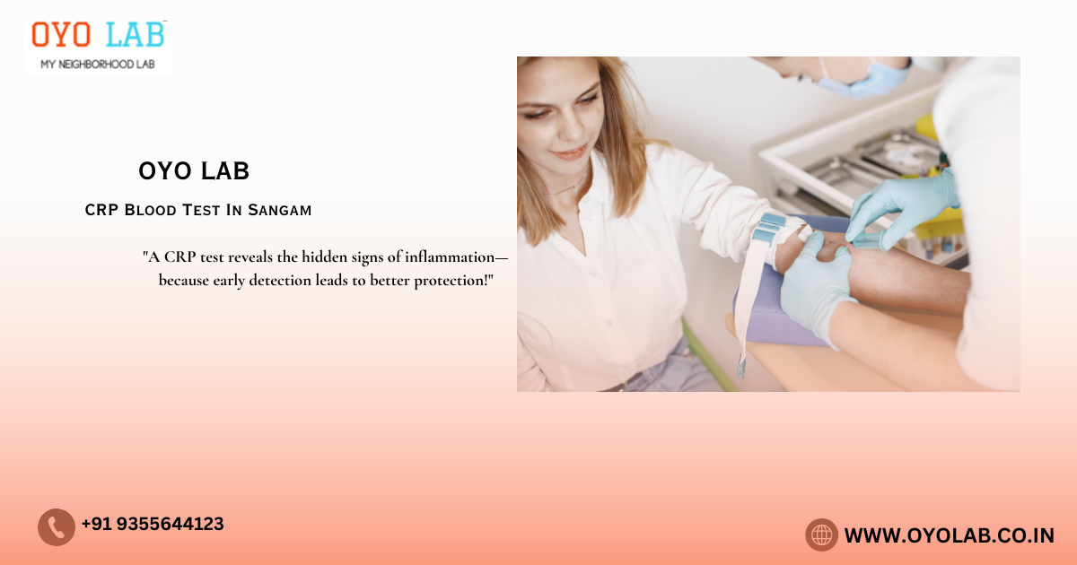 CRP Blood Test In Sangam Vihar