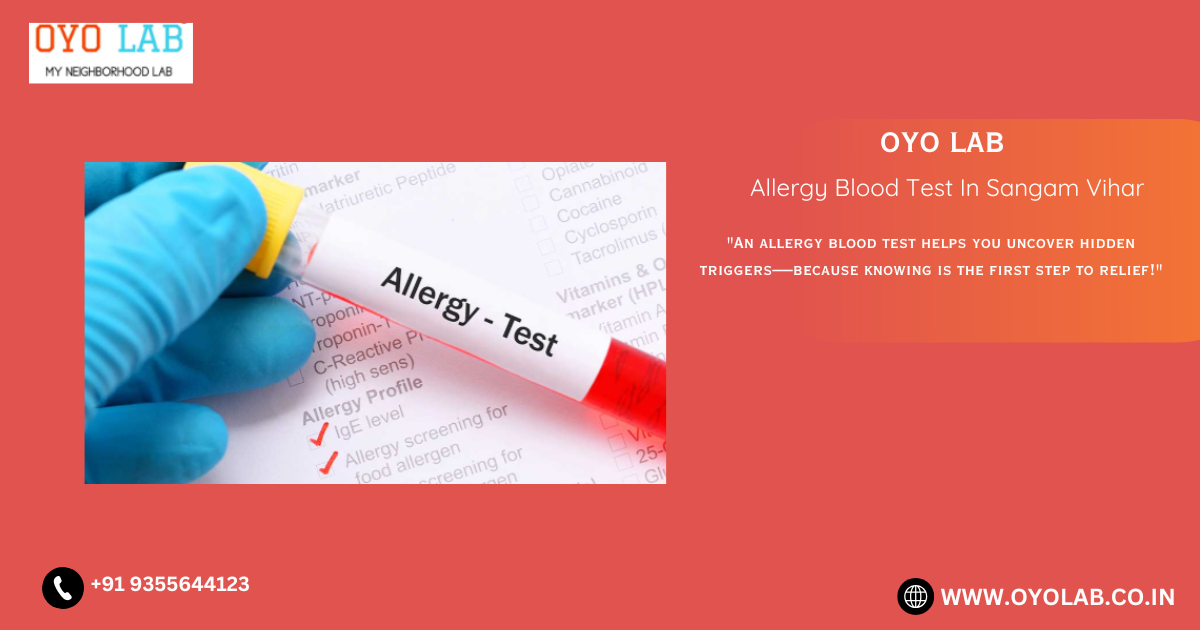 Allergy Blood Test In Sangam Vihar