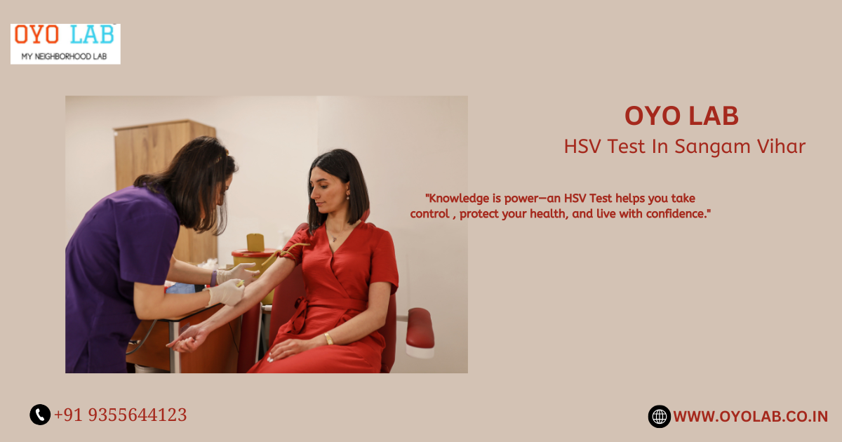 HSV Test In Sangam Vihar