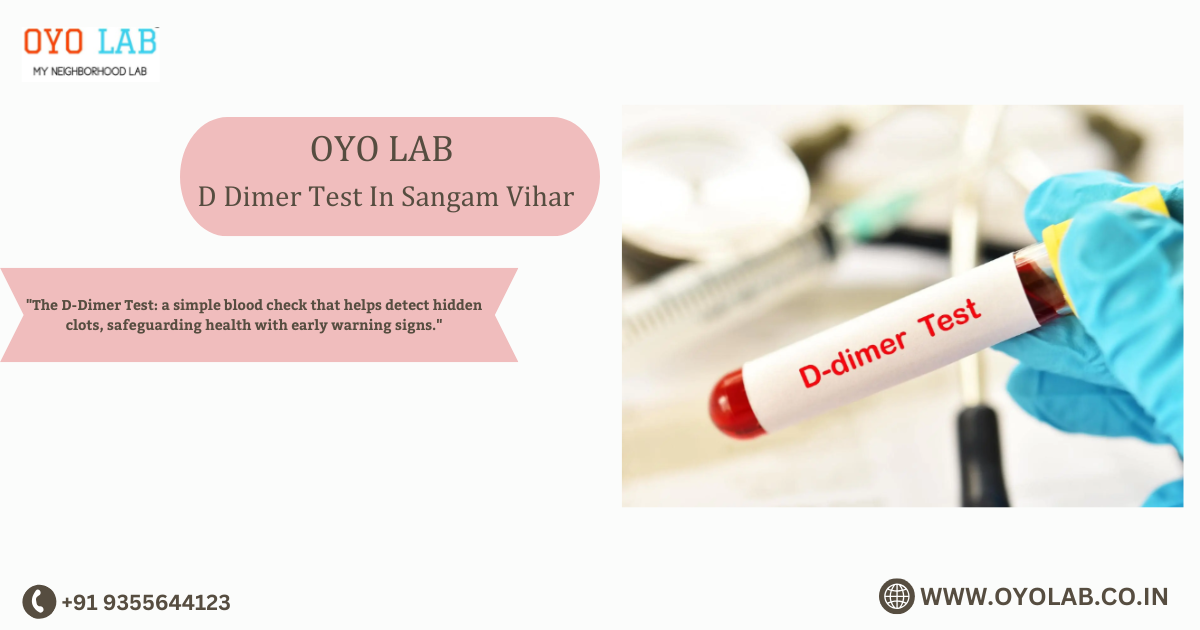 D Dimer Test In Sangam Vihar