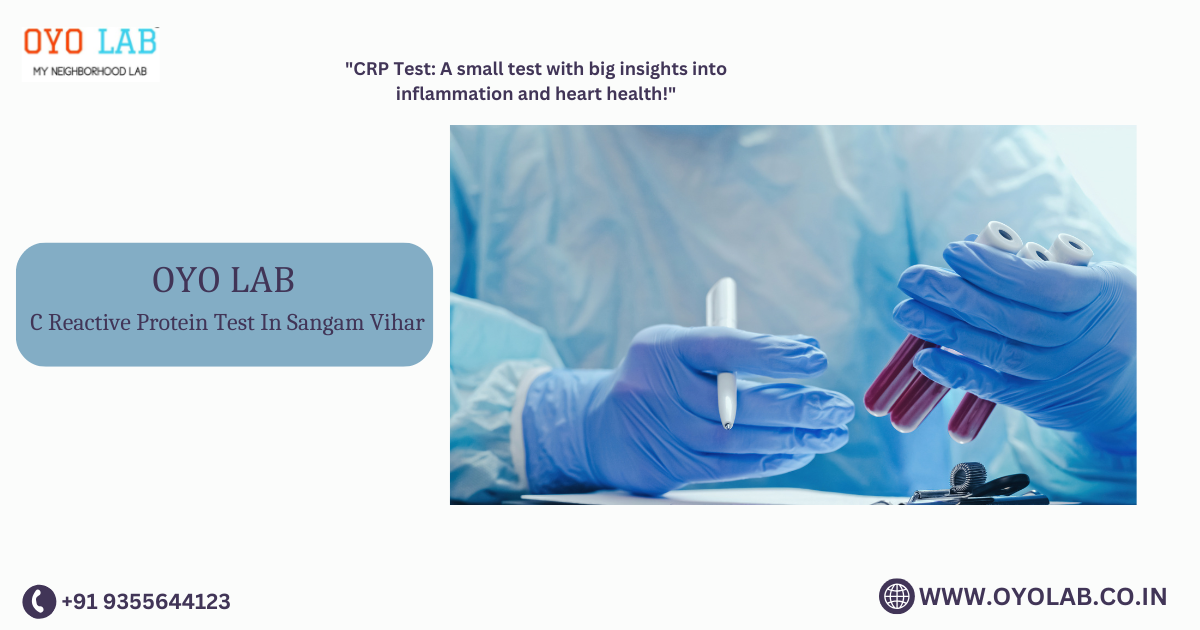C Reactive Protein Test In Sangam Vihar