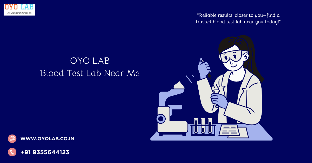 Blood Test Lab Near Me
