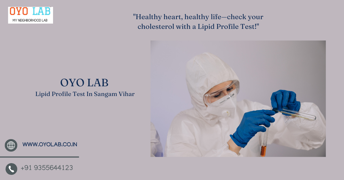 Lipid Profile Test In Sangam Vihar