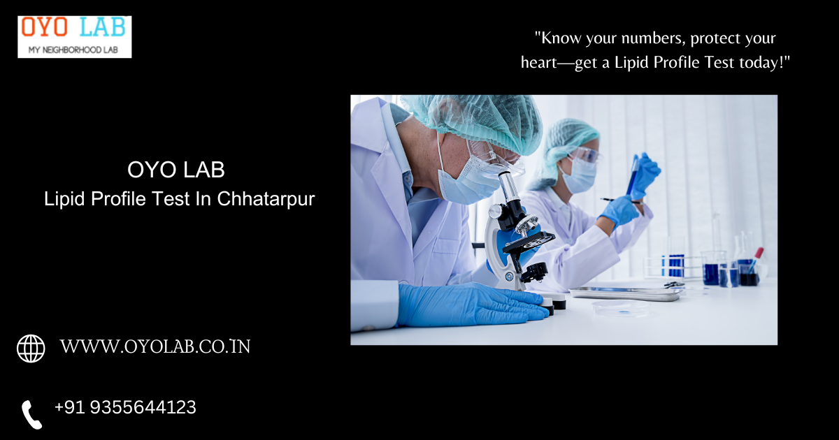 Lipid Profile Test In Chhatarpur