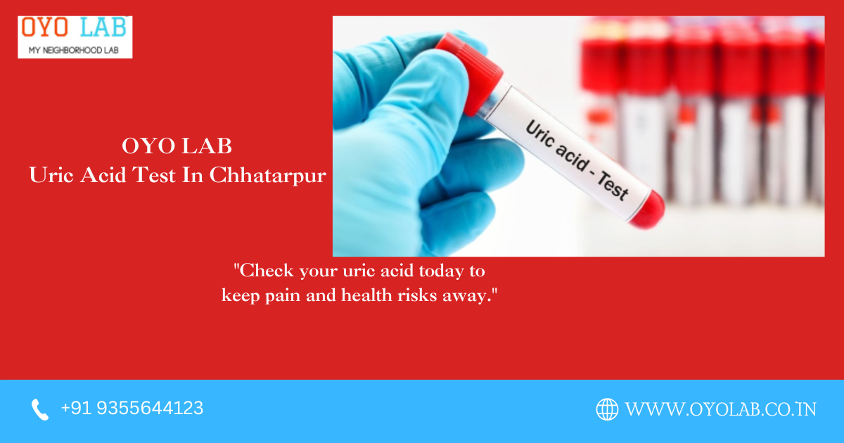 Uric Acid Test In Chhatarpur