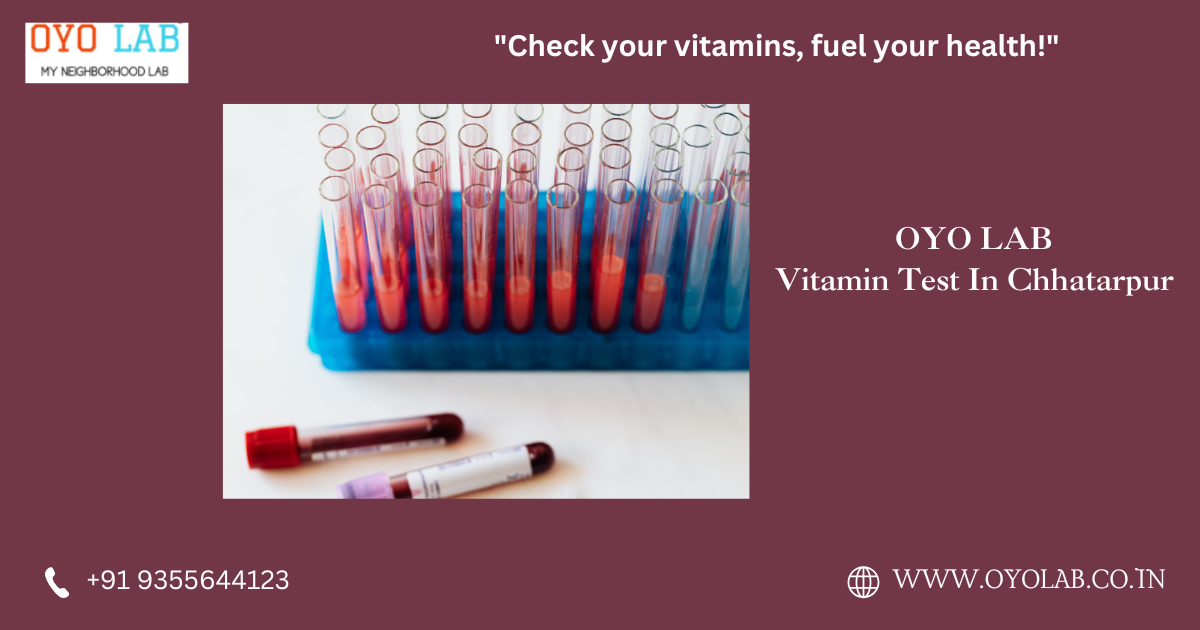 Vitamin Test In Chhatarpur