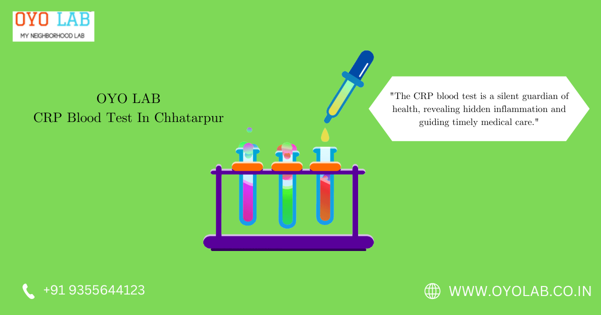 CRP Blood Test In Chhatarpur