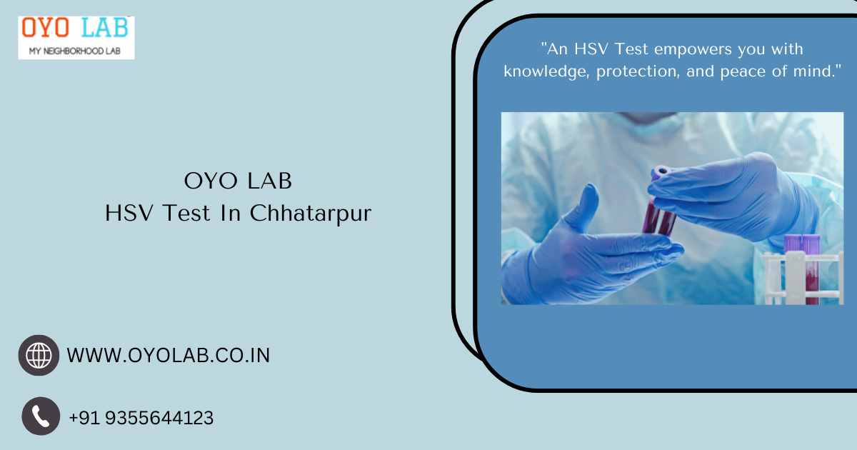 HSV Test In Chhatarpur