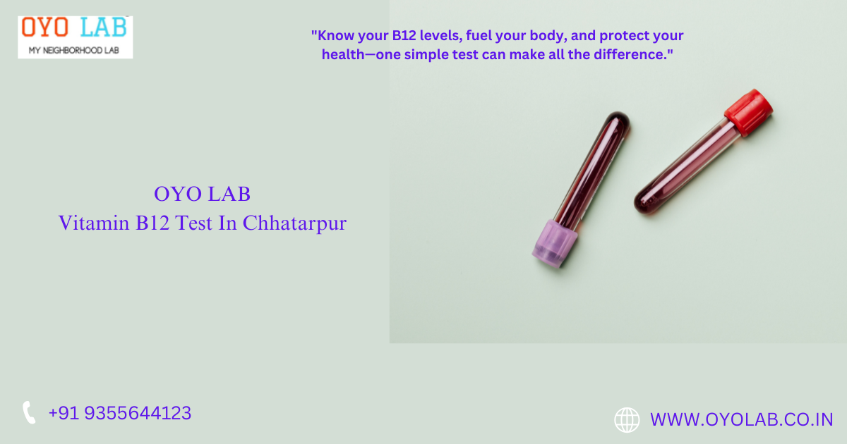 Vitamin B12 Test In Chhatarpur