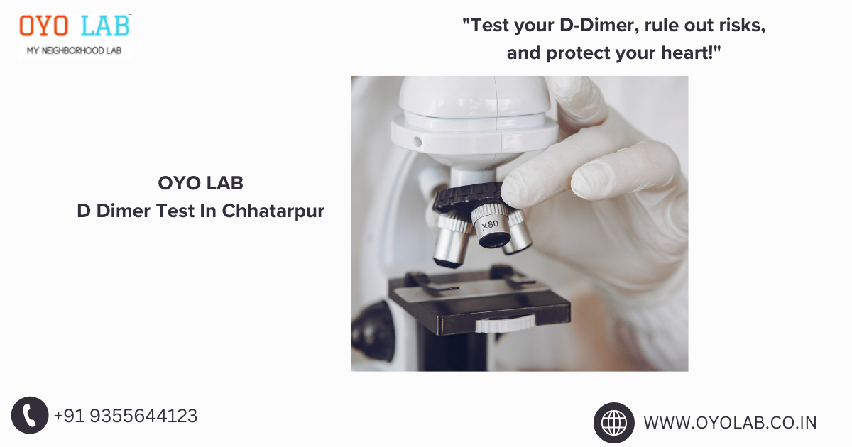 D Dimer Test In Chhatarpur