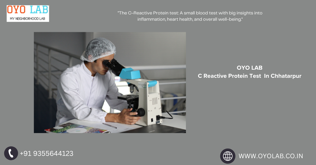 C Reactive Protein Test In Chhatarpur