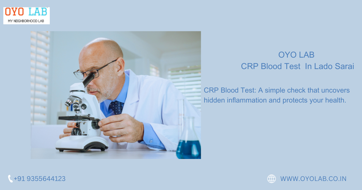 CRP Blood Test In Lado Sarai