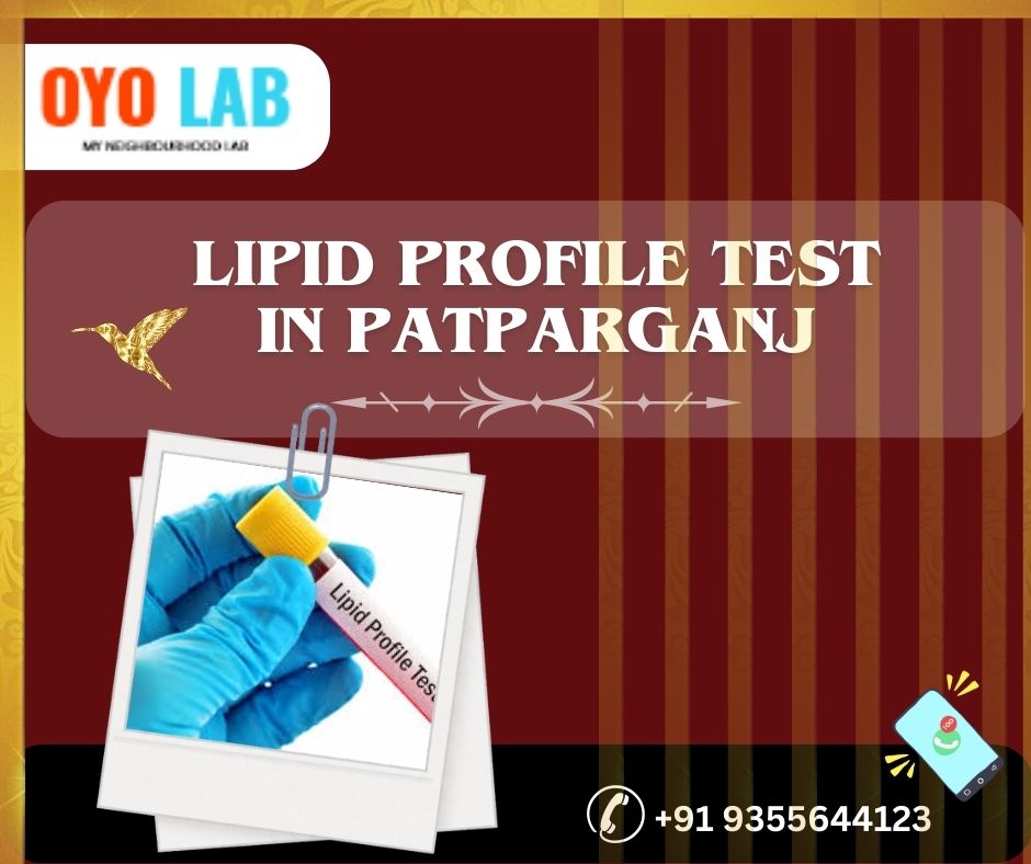 lipid profile test in patparganj