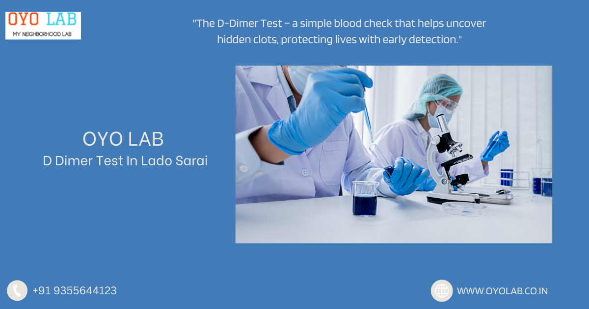 D Dimer Test In Lado Sarai