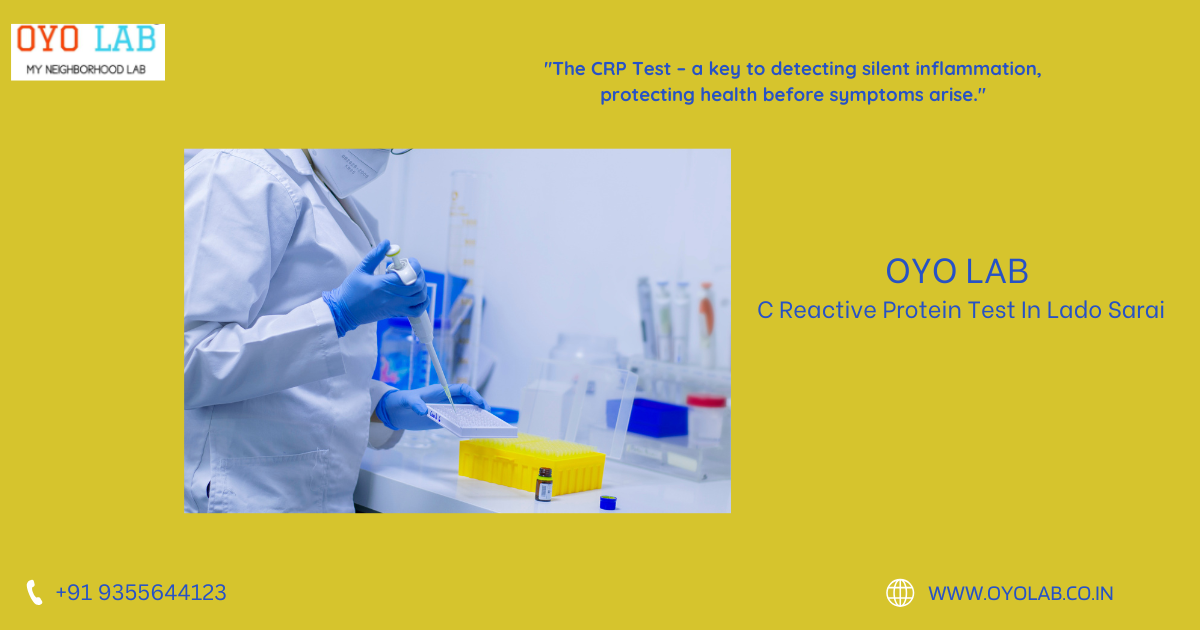 C Reactive Protein Test In Lado Sarai