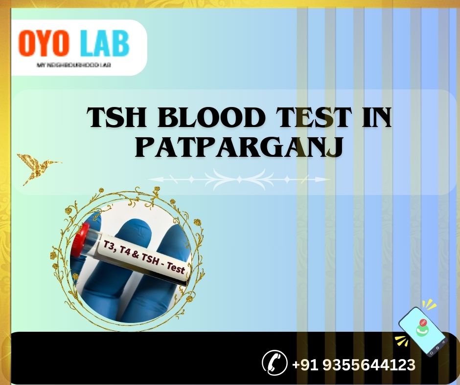 TSH blood test in patparganj