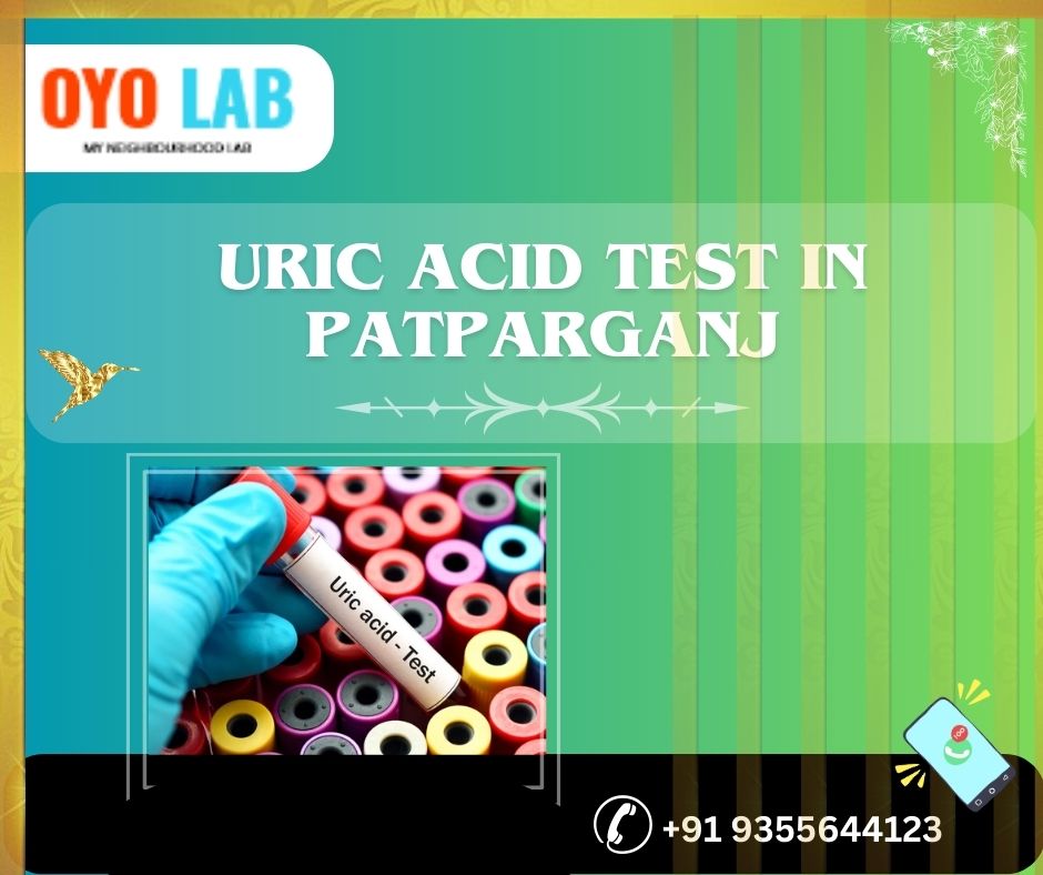 uric acid test in patparganj