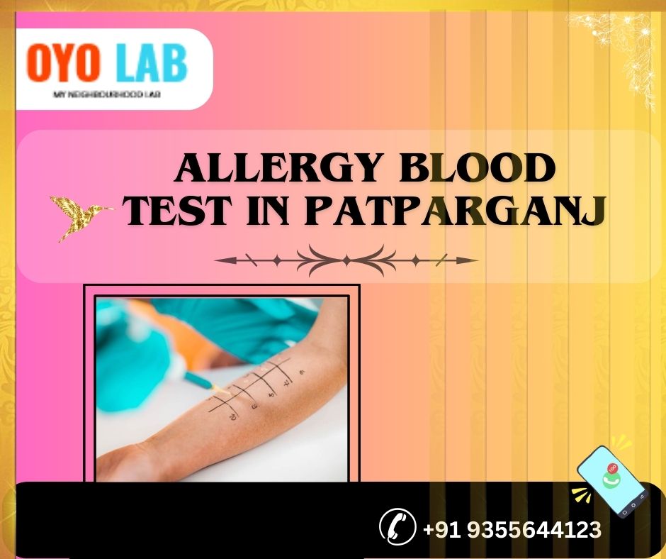 allergy blood test in patparganj