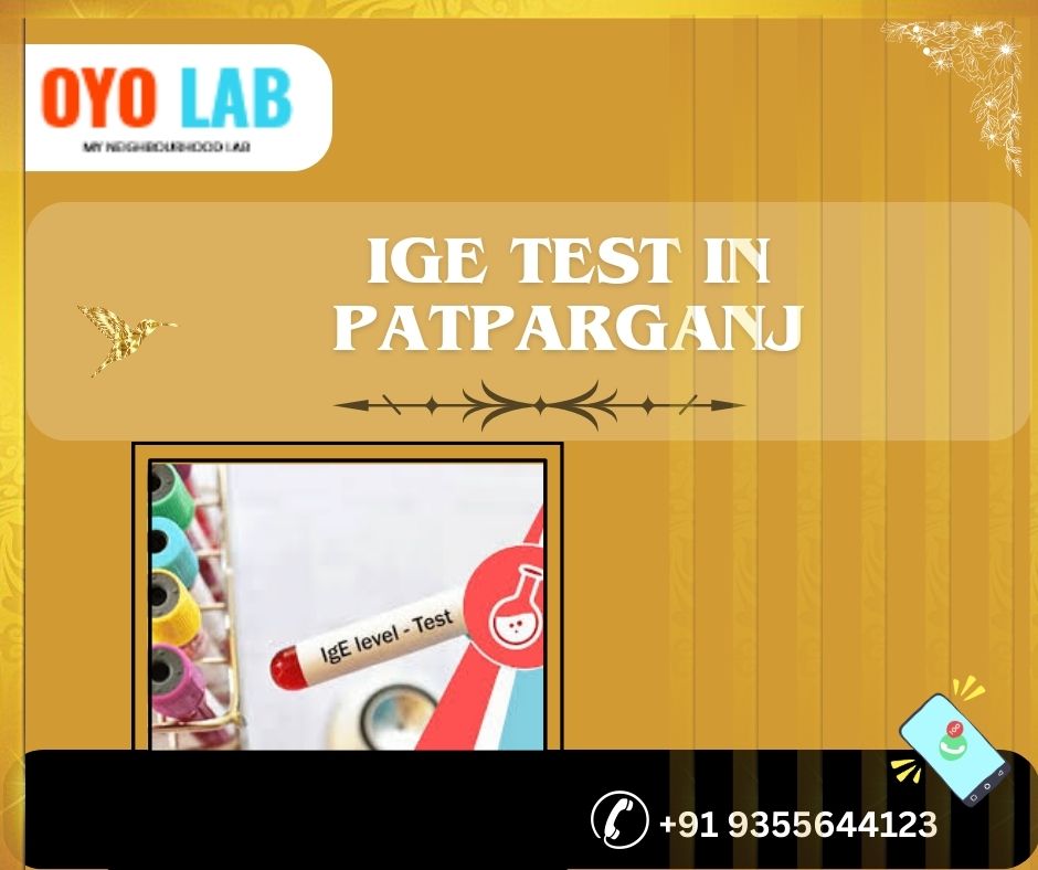 ige test in patparganj