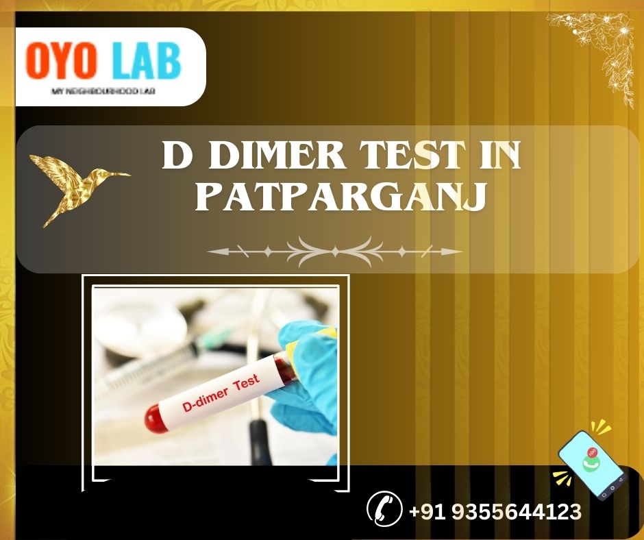 D dimer test in patparganj