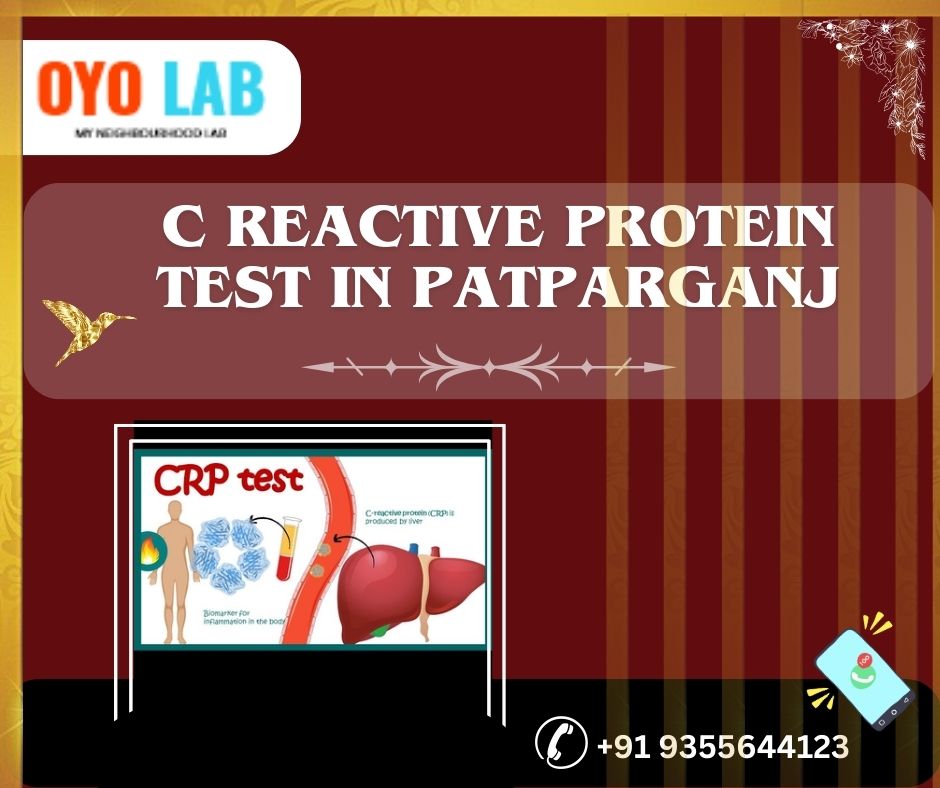 c reactive protein test in patparganj