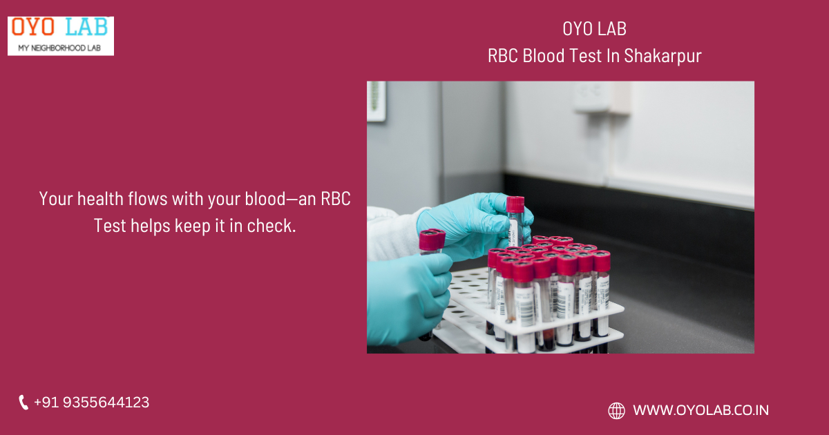 RBC Blood Test In Shakarpur