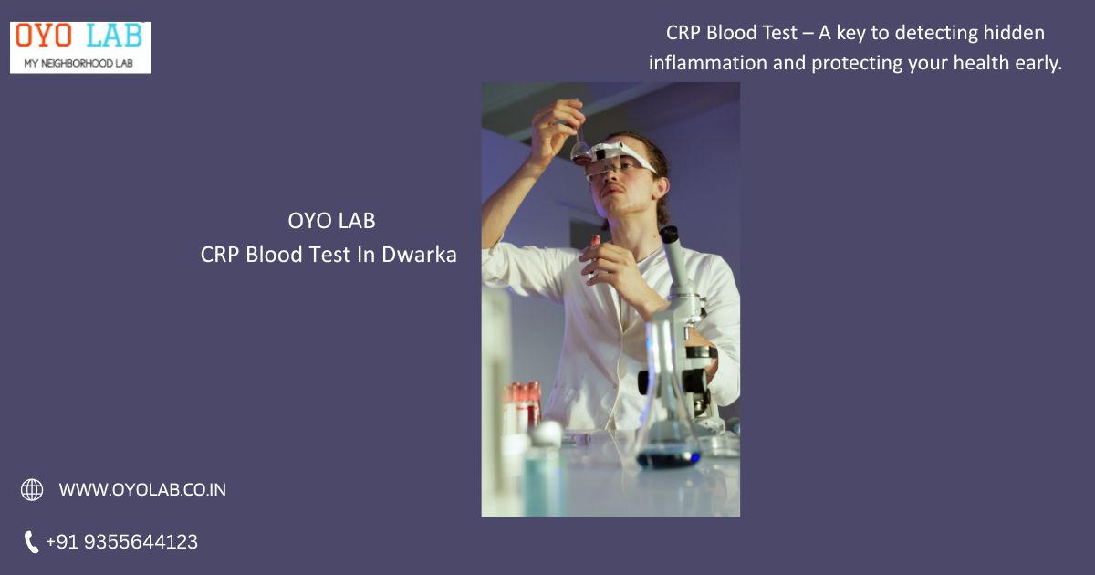 CRP Blood Test In Dwarka