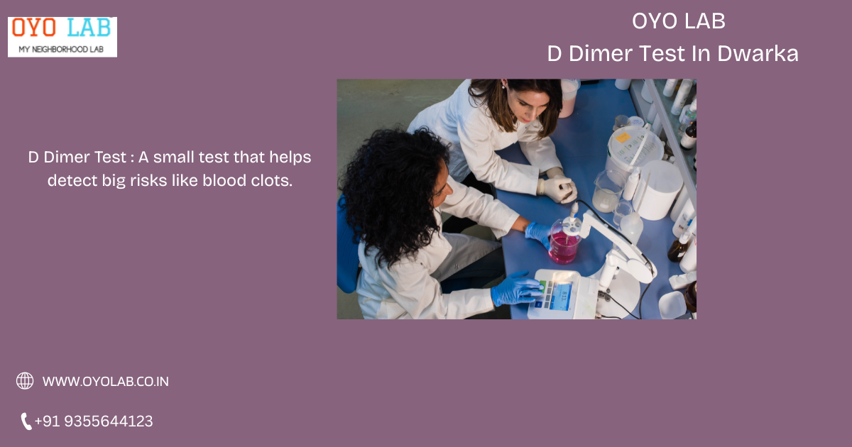 D Dimer Test In Dwarka