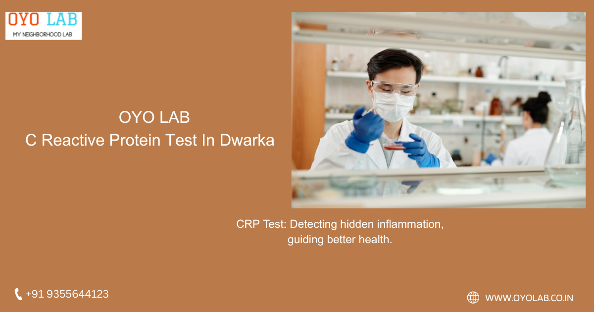 C Reactive Protein Test In Dwarka