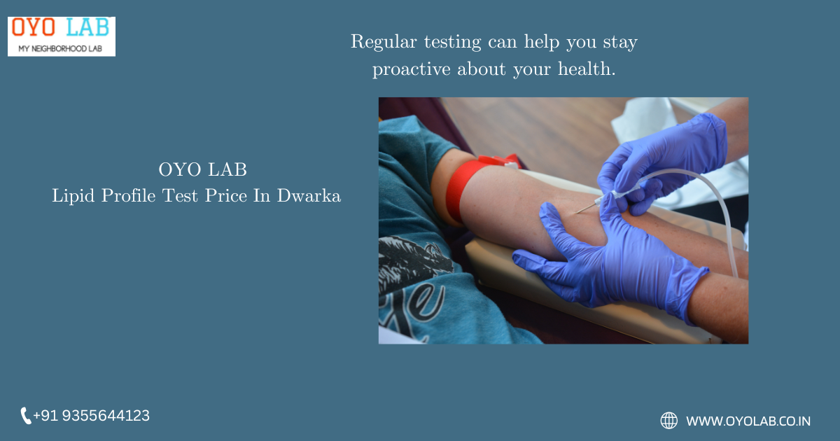 Lipid Profile Test Price In Dwarka