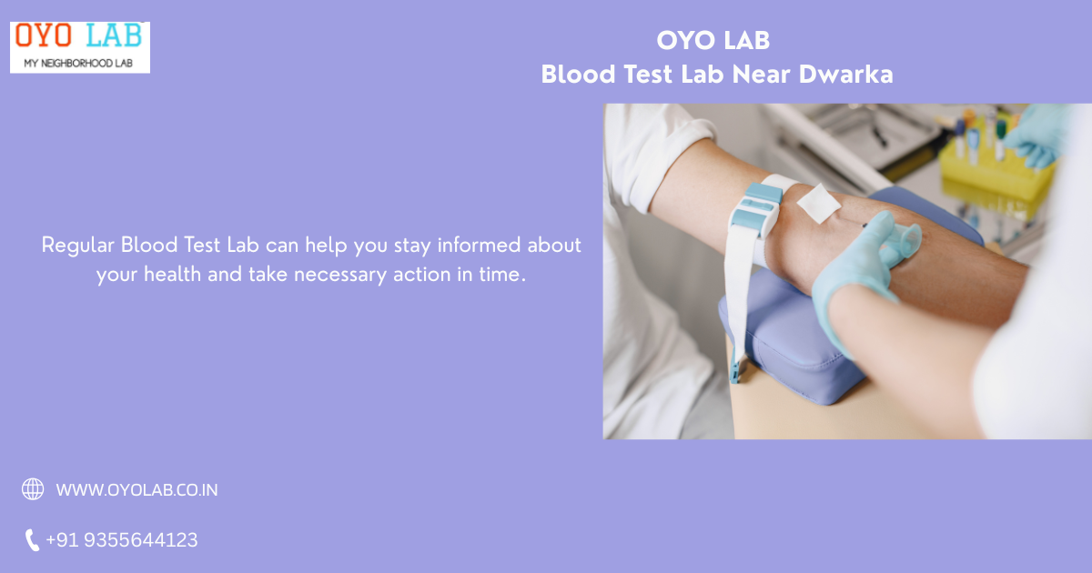 Blood Test Lab Near Dwarka
